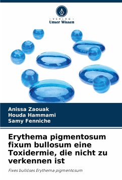 Erythema pigmentosum fixum bullosum eine Toxidermie, die nicht zu verkennen ist - Zaouak, Anissa;Hammami, Houda;Fenniche, Samy