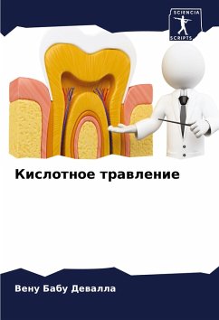 Cover Kislotnoe trawlenie