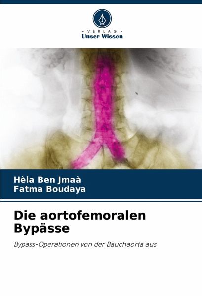 Die aortofemoralen Bypässe Die aortofemoralen Bypässe