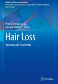 Hair Loss Hair Loss