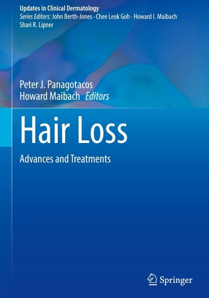 Hair Loss Hair Loss