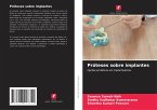 Próteses sobre implantes