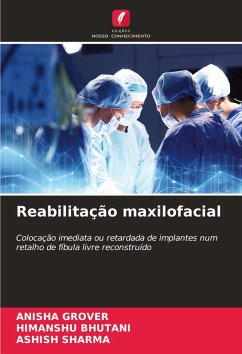 Reabilitação maxilofacial - GROVER, ANISHA;Bhutani, Himanshu;Sharma, Ashish