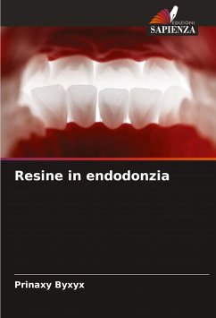 Resine in endodonzia - Byxyx, Prinaxy