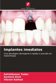 Implantes imediatos - Yadav, Satishkumar;Dixit, Santosh;Rathod, Vikram
