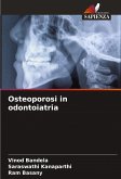 Osteoporosi in odontoiatria Osteoporosi in odontoiatria
