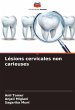 Lésions cervicales non carieuses - Bild 1