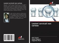 Lesioni cervicali non cariose - Tomer, Anil;Miglani, Anjali;Muni, Sagarika