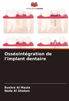 Osséointégration de l'implant dentaire - Al Maula, Bushra;Al Ghaban, Nada