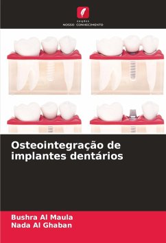 Osteointegração de implantes dentários - Al Maula, Bushra;Al Ghaban, Nada