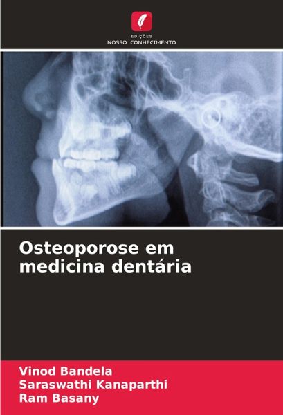 Osteoporose em medicina dentária