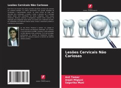 Lesões Cervicais Não Cariosas - Tomer, Anil;Miglani, Anjali;Muni, Sagarika