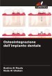 Osteointegrazione dell'impianto dentale - Bild 1