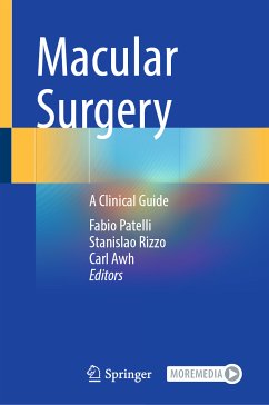 Macular Surgery (eBook, PDF)