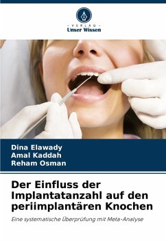 Der Einfluss der Implantatanzahl auf den periimplantären Knochen - Elawady, Dina;Kaddah, Amal;Osman, Reham