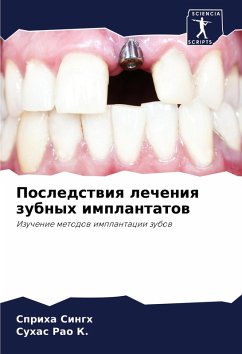 Cover Posledstwiq lecheniq zubnyh implantatow
