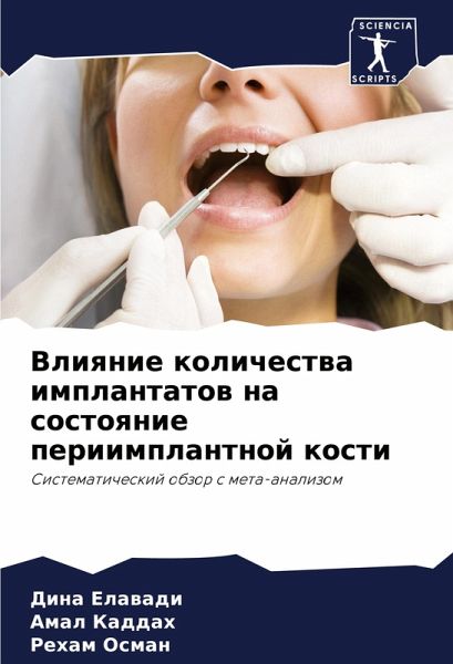 Vliqnie kolichestwa implantatow na sostoqnie periimplantnoj kosti Vliqnie kolichestwa implantatow na sostoqnie periimplantnoj kosti