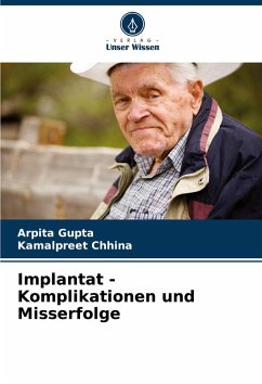 Implantat - Komplikationen und Misserfolge - Gupta, Arpita;Chhina, Kamalpreet