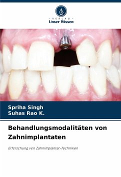 Behandlungsmodalitäten von Zahnimplantaten - Singh, Spriha;K., Suhas Rao