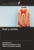 Post y núcleo Post y núcleo