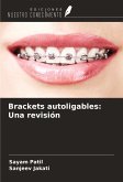 Brackets autoligables: Una revisión