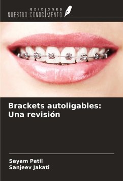 Brackets autoligables: Una revisión - Patil, Sayam; Jakati, Sanjeev