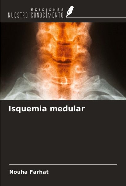 Isquemia medular
