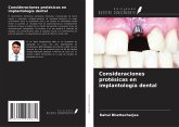 Consideraciones protésicas en implantología dental