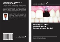 Consideraciones protésicas en implantología dental - Bhattacharjee, Rahul