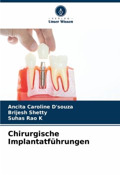 Chirurgische Implantatführungen - D'souza, Ancita Caroline;Shetty, Brijesh;K, Suhas Rao