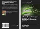 Inflamación inducida por H. pylori en la patogénesis del cáncer gástrico Inflamación inducida por H. pylori en la patogénesis del cáncer gástrico