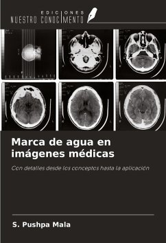 Cover Marca de agua en imágenes médicas