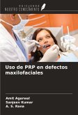 Uso de PRP en defectos maxilofaciales