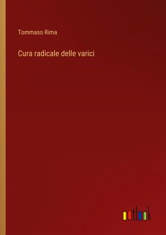 Cura radicale delle varici