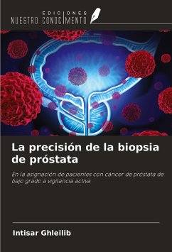 La precisión de la biopsia de próstata - Ghleilib, Intisar