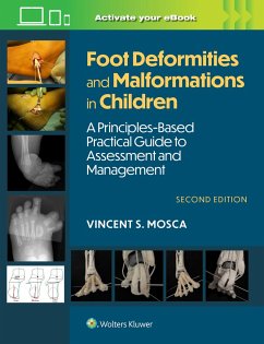 Foot Deformities and Malformations in Children - Mosca, Vincent