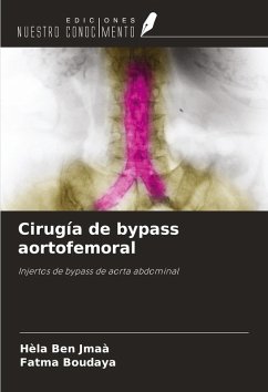 Cover Cirugía de bypass aortofemoral