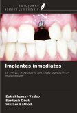 Implantes inmediatos Implantes inmediatos