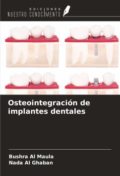 Osteointegración de implantes dentales - Al Maula, Bushra; Al Ghaban, Nada