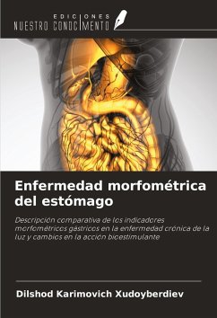Enfermedad morfométrica del estómago - Xudoyberdiev, Dilshod Karimovich