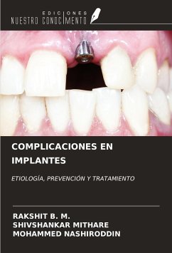 COMPLICACIONES EN IMPLANTES - B. M., Rakshit; Mithare, Shivshankar; Nashiroddin, Mohammed