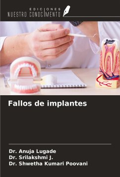 Fallos de implantes - Lugade, Anuja; J., Srilakshmi; Poovani, Shwetha Kumari