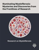 Illuminating Myelofibrosis