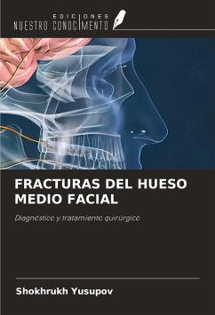 FRACTURAS DEL HUESO MEDIO FACIAL - Yusupov, Shokhrukh