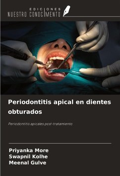 Cover Periodontitis apical en dientes obturados
