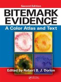 Bitemark Evidence Bitemark Evidence