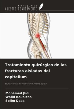 Cover Tratamiento quirúrgico de las fracturas aisladas del capitellum