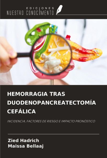 HEMORRAGIA TRAS DUODENOPANCREATECTOMÍA CEFÁLICA
