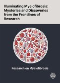 Illuminating Myelofibrosis