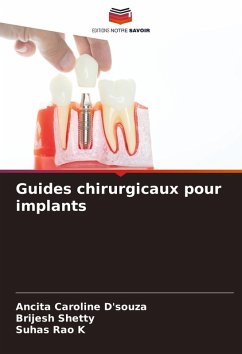 Guides chirurgicaux pour implants - D'souza, Ancita Caroline;Shetty, Brijesh;K, Suhas Rao